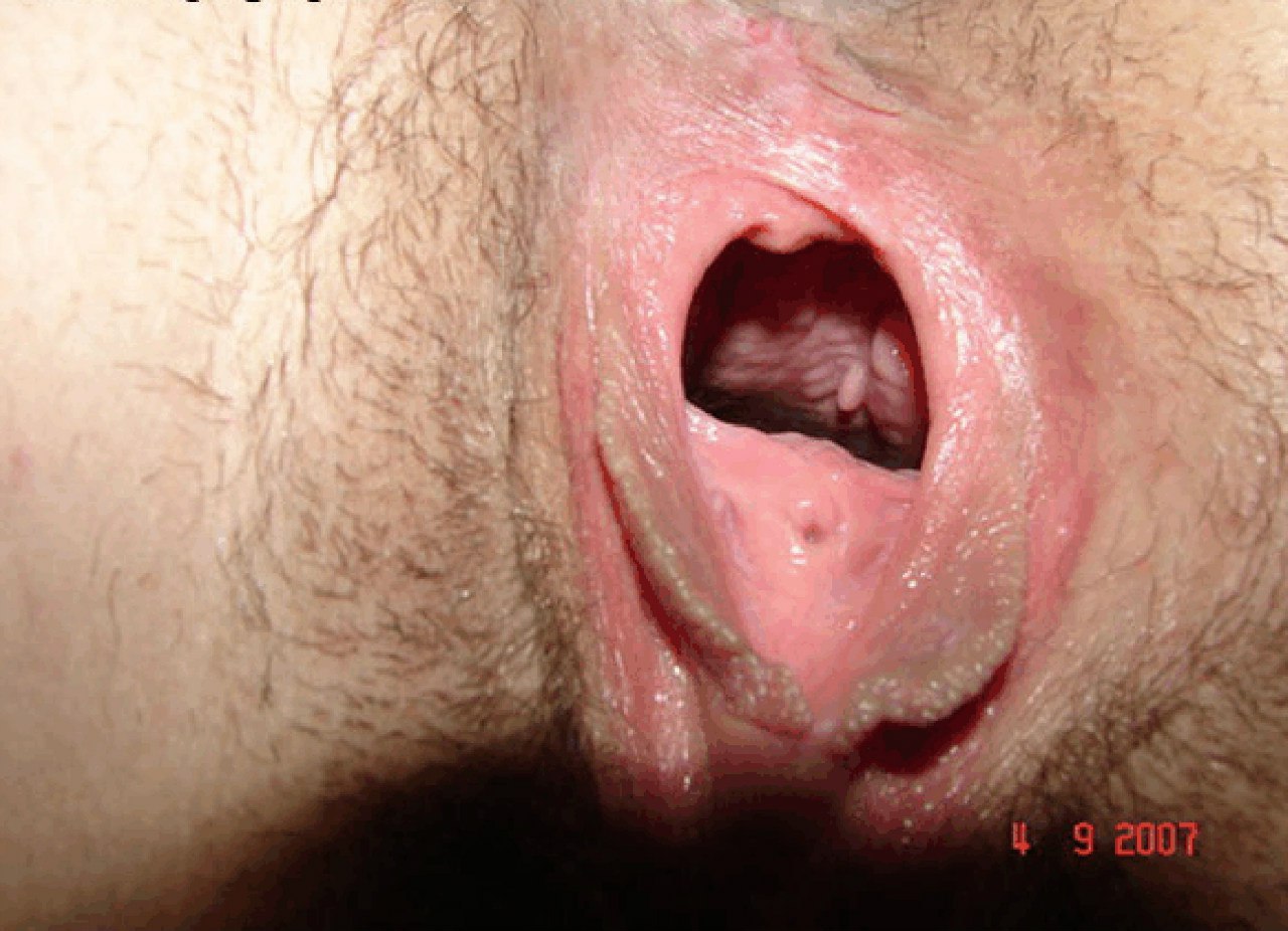 Подборка раскрытых писечек и анусов девушек с близких ракурсов 1 фото