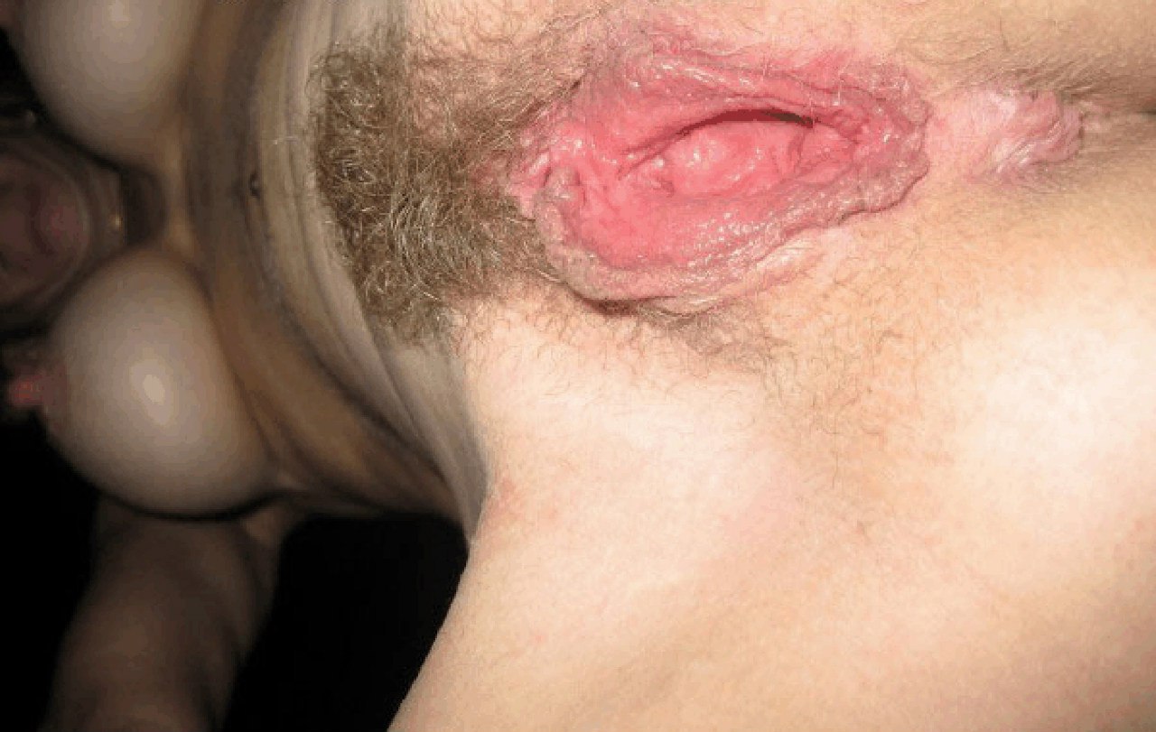 Подборка раскрытых писечек и анусов девушек с близких ракурсов 10 фото