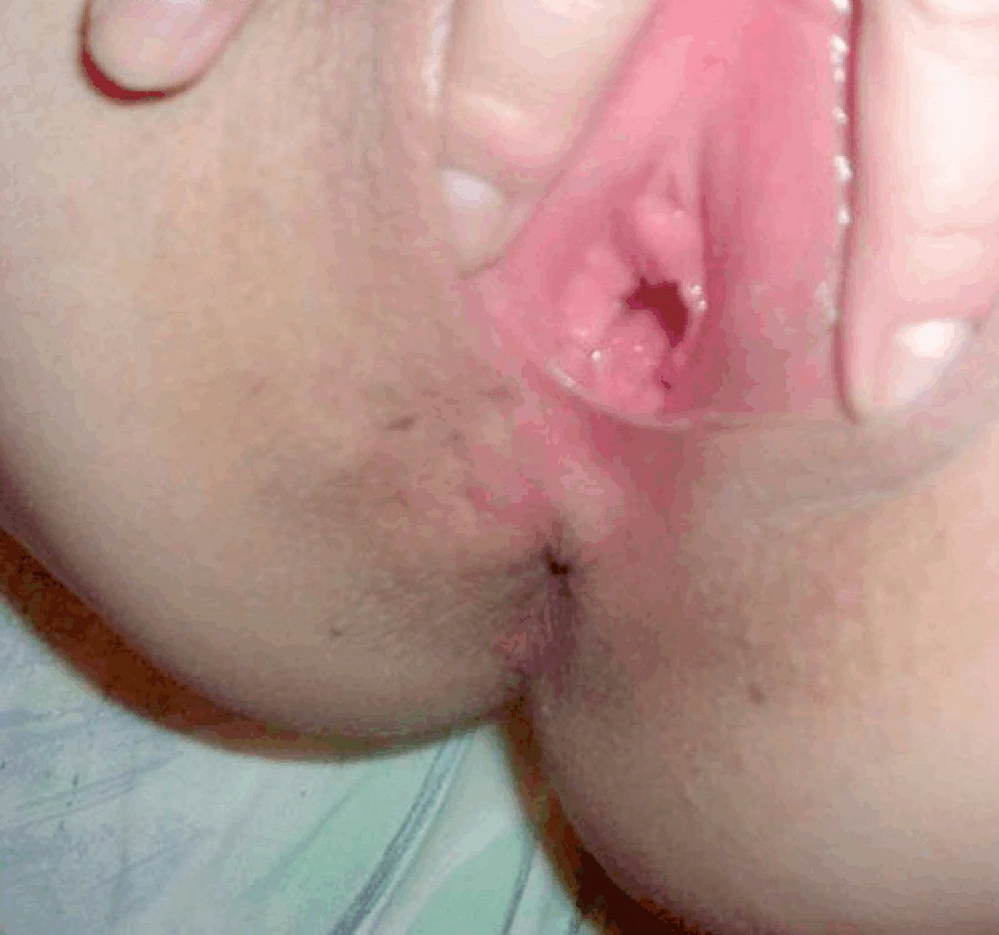 Подборка раскрытых писечек и анусов девушек с близких ракурсов 15 фото